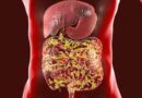 Detectan cómo el microbioma intestinal puede aumentar el riesgo de COVID prolongado