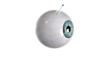 Científicos crean una microaguja para el ojo que se descompone dentro del globo ocular tras la administración gradual del fármaco