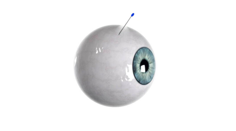 Científicos crean una microaguja para el ojo que se descompone dentro del globo ocular tras la administración gradual del fármaco