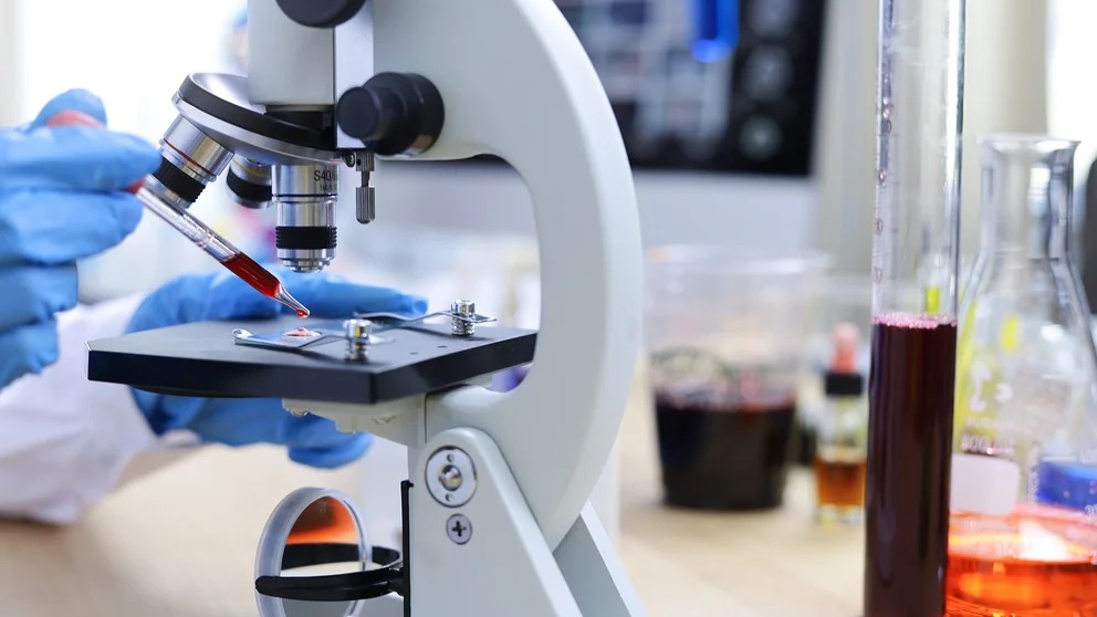 Un análisis de sangre podría detectar el Alzheimer más de tres años antes de su diagnóstico