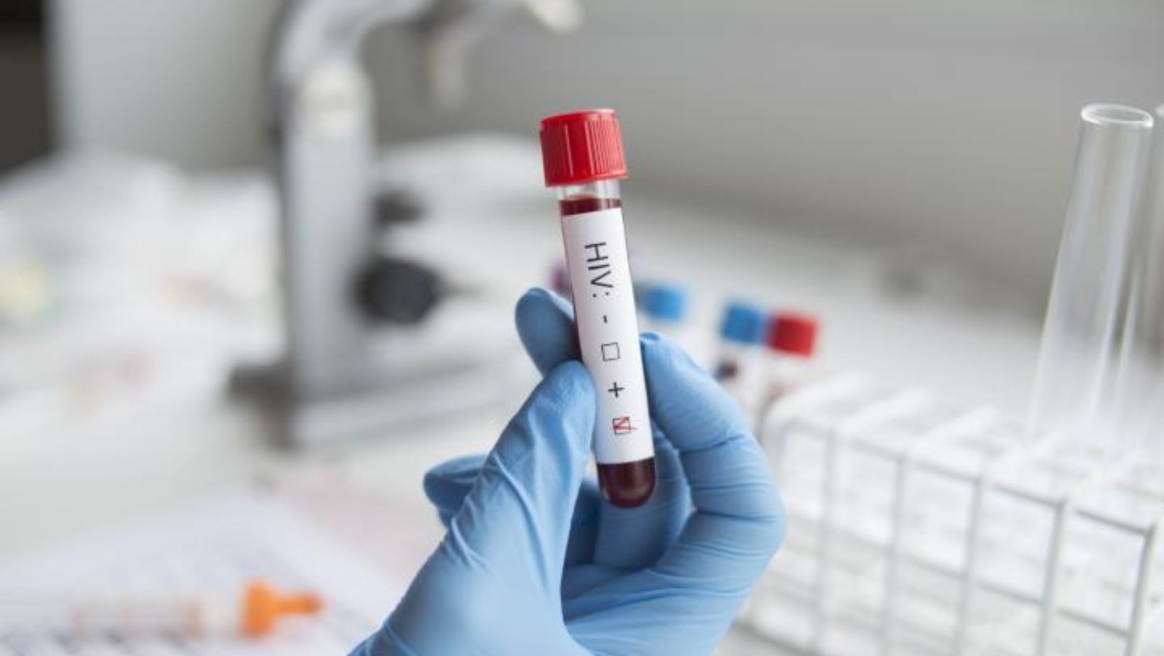Estudio muestra tercer paciente curado de infección por VIH  