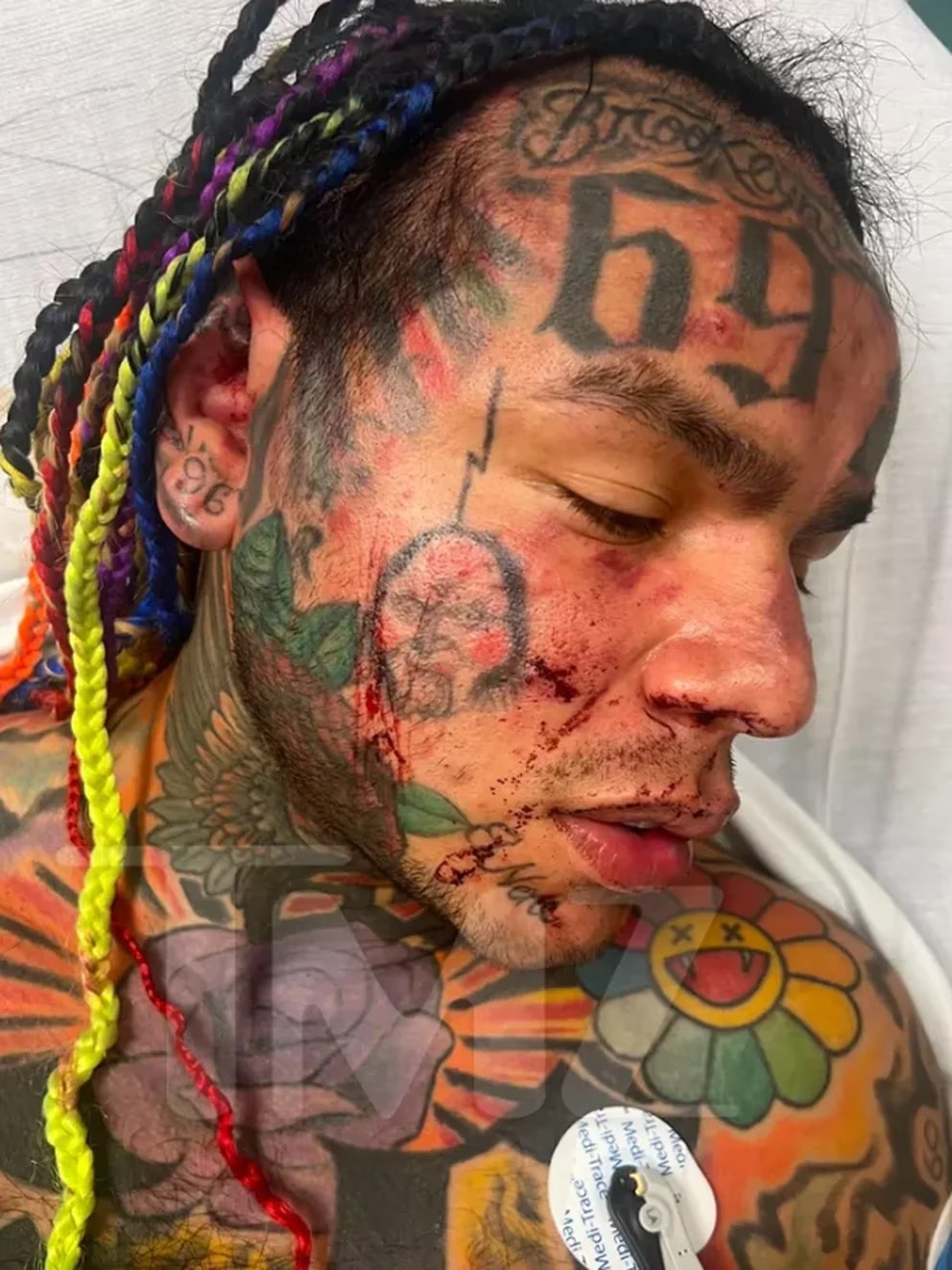 El rapero Tekashi 6ix9ine fue hospitalizado de emergencia tras recibir una brutal golpiza en un gimnasio de Florida
