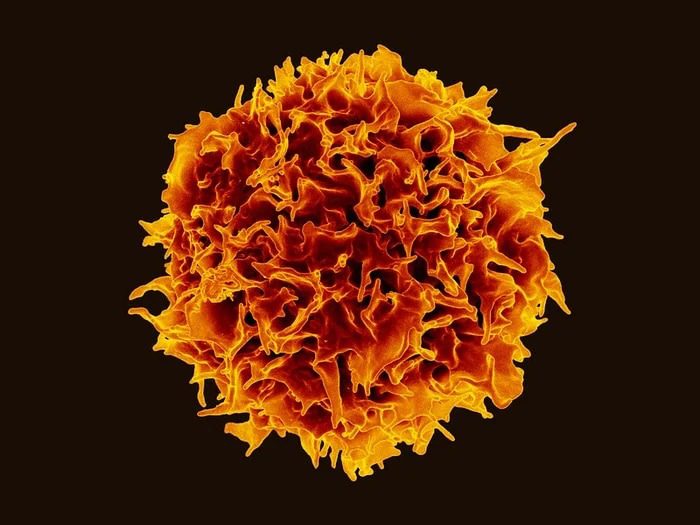 Se trata de un paso hacia la resolución del problema de la latencia del virus en las células. En qué consiste el hallazgo y por qué podrían ayudar a conseguir la cura de la infección Más de 38,4 millones de personas viven con el virus de la inmunodeficiencia humana, más conocido como VIH (o HIV en inglés) en todo el mundo. Dentro de ese total, se estima que 28,7 millones de personas con la infección acceden hoy al tratamiento. Uno de los principales obstáculos para curar la infección por VIH es el reservorio de larga vida de células T CD4+ infectadas que están en forma latente. Esas células son resistentes al tratamiento y, por los tanto, permiten la persistencia del virus en el organismo humano. Ahora, un equipo liderado por científicos de España ha realizado un hallazgo que abre un camino para encontrar mejores estrategias para llegar a curar las infecciones por el VIH. El estudio, que contó con la colaboración de investigadores de Estados Unidos y Japón, fue publicado en la revista Communications Biology. Los líderes fueron investigadores de los laboratorios de Biología de la Infección y Virología Molecular de la Universidad Pompeu Fabra. Lograron identificar y caracterizar a un nuevo factor de restricción del virus VIH. Un equipo de investigadores del Grupo de Investigación en Biología de la Infección de la Universidad Pompeu Fabra de España hizo un hallazgo que abre el camino hacia mejores tratamientos (UPF) Le llamaron “Schlafen”. Es una palabra alemana que significa “dormido” y que da nombre a una familia de proteínas implicadas en el cáncer, la sensibilidad a los medicamentos y las funciones antivirales. Schlafen 12 (SLFN 12) es entonces un nuevo factor de restricción del VIH. Descubrieron que SLFN 12 detiene la producción de proteínas virales y ayuda a las células infectadas por el virus a escapar de la terapia contra el VIH y de las respuestas inmunitarias. Si no se tratan, las infecciones por el virus de la Inmunodeficiencia Humana (VIH), se produce la destrucción gradual del sistema inmunitario. En todo el mundo, unas 650.000 personas mueren cada año por los estadios avanzados de la infección. A pesar de que no existe una cura general para una infección establecida, una terapia antirretroviral adecuada permite a las personas con el virus tener una buena calidad de vida. Sin embargo, una vez que se interrumpe el tratamiento, el virus reaparece a partir de un reservorio de células infectadas en estado latente. Los científicos encontraron que la proteína Schlafen 12 (SLFN 12) ayuda a las células infectadas por el virus a escapar de la terapia contra el VIH y de las respuestas inmunitarias “La latencia es una barrera importante que impide la eliminación del virus en las personas infectadas por el VIH. No podremos curar una infección existente hasta que nos deshagamos de las células infectadas de forma latente. Por eso es esencial entender cómo funciona la latencia”, explicó Andreas Meyerhans, profesor de investigación ICREA en la UPF que ha coordinado el estudio junto a Juana Díez. A partir del estudio publicado en Communication Biology se caracterizó a SLFN12 como una proteína que restringe la proteínas virales mediante la escisión de ARNt celulares específicos, que son los componentes básicos para la construcción de proteínas. Como consecuencia, en presencia de SLFN12 activa, las células T CD4 infectadas por el VIH no son capaces de completar el proceso de producción del virus, sino que mantienen sus plantillas, el ARN del VIH, en estado latente. “SLFN12 impide la producción de proteínas, restringiendo la producción de partículas virales. Tales células están infectadas de forma latente, invisibles al sistema inmunitario y a las terapias contra el VIH”, explicó Mie Kobayashi-Ishihara, primera autora del trabajo. Se estima que si se bloquearan a la proteína identificada se iría a favor del sistema inmunitario del paciente y para que los fármacos antivirales eliminen mejor los reservorios virales/NIAID El estudio también revela cómo SLFN12 puede inhibir específicamente la producción de proteínas del VIH sin bloquear la producción de proteínas celulares. “SLFN12 escinde el ARNt Leucina-UUA, un bloque de construcción que rara vez se utiliza para las proteínas celulares pero que es esencial para las proteínas virales del VIH”, explicó la científica Juana Díez. El hallazgo abre la posibilidad de diseñar nuevas estrategias terapéuticas contra el VIH. “Bloquear las funciones antivirales de SLFN12 debería aumentar la expresión de proteínas virales y, por tanto, permitir al sistema inmunitario del huésped y a los fármacos antivirales eliminar mejor los reservorios virales”, vislumbró Meyerssshans. “Una vez que empiezas a producir el virus, vuelve a ser visible. Vuelves a tener tu objetivo. Así que puedes atacarlo y, con suerte, eliminar definitivamente las células infectadas latentes”, agregó. En Argentina, científicos también descubrieron un circuito regulatorio que hace que el virus VIH se pueda mantener latente en reservorios dentro del cuerpo humano. Lo publicaron el año pasado “La investigación liderada por científicos de España describe el rol potencial de una proteína en la regulación del reservorio del HIV. Las Schlafen son una familia de proteínas con diversas funciones, entre otras sobre la actividad de proliferación de algunos tumores. En este sentido, se han descripto roles potenciales como biomarcadores de actividad tumoral y de blanco de acción de tratamientos. En este caso, se podría especular acerca de su regulación farmacológica y eventual actividad sobre el reservorio para VIH. Pero aún me parece demasiado preliminar”, opinó al ser consultado por Infobae el doctor Marcelo Losso, director del Servicio de Inmunocomprometidos e investigador responsable del área de enfermedades emergentes del Hospital Ramos Mejía de Buenos Aires en Argentina. En agosto del año pasado, investigadores de la Argentina y otros países también descubrieron un circuito regulatorio que hace que el virus VIH se pueda mantener latente en reservorios dentro del cuerpo humano. El trabajo se publicó en la revista especializada mBio de la Sociedad Estadounidense de Microbiología. Se trató de un estudio que forma parte de la tesis doctoral de Julia Rubione como becaria del Conicet y en el que participaron investigadores de Chile y Australia. El trabajo de Rubione con la coordinación de Matías Ostrowski, del Instituto de Investigaciones Biomédicas y Retrovirus (INBIRS), de la Facultad de Medicina de la Universidad de Buenos Aires y el Conicet, y Gabriel Rabinovich, del Instituto de Biología y Medicina Experimental del Conicet y la Facultad de Ciencias Exactas y Naturales de la UBA, aportó nuevos conocimientos para entender mejor la persistencia y la dinámica del reservorio viral. Abrió una posibilidad de que se pasen a evaluar fármacos dirigidos hacia la proteína, llamada galectina 1, que Rubione y los colaboradores encontraron en niveles aumentados tanto en personas con acceso al tratamiento o sin medicación.