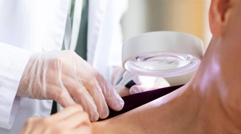 En el país se diagnostican entre siete y ocho pacientes con cáncer de piel cada día
