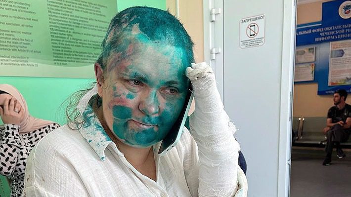 Brutal ataque a periodista rusa en Chechenia desata repudio mundial: ONGs piden "poner fin a la impunidad"