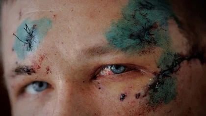 Traumas, heridas, destrucción y colaboracionismo: las terribles secuelas que dejó Rusia en la Ucrania liberada