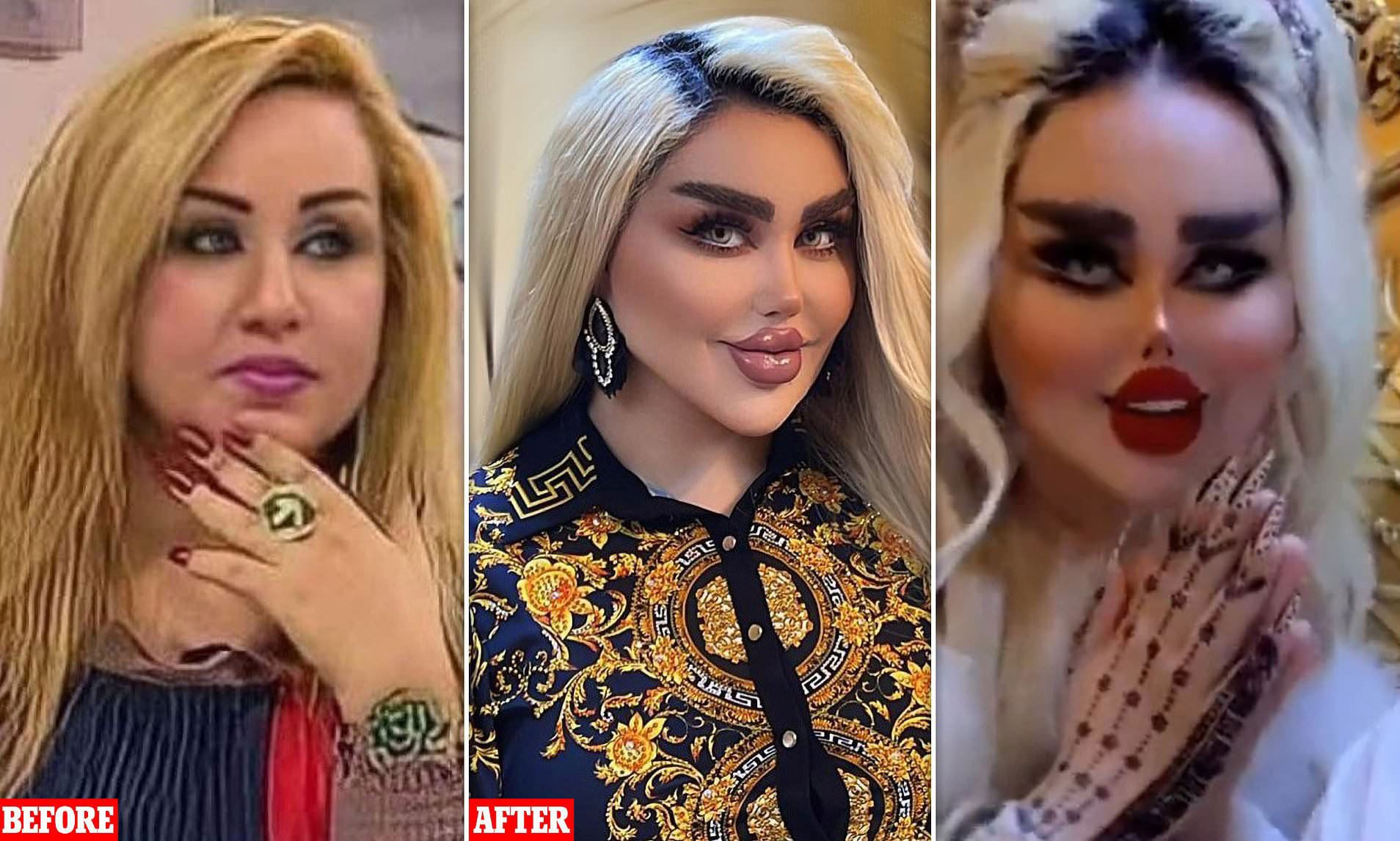 Se hizo más de 40 cirugías para ser como barbie, pero dicen que se ve como ‘zombie’