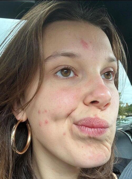 Millie Bobby Brown comparte una foto sin maquillaje: “¡Ayuda!”