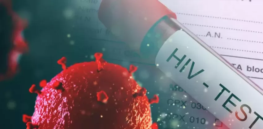 Cerca de 79,000 en el país viven con VIH