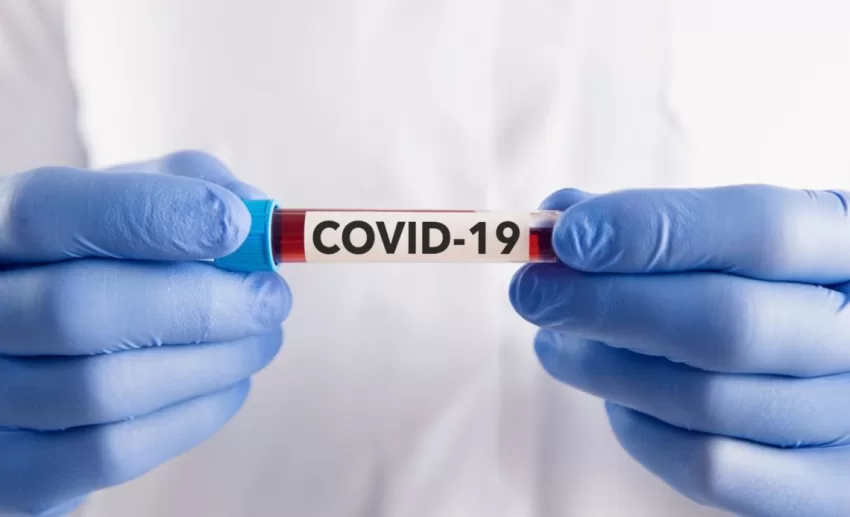 En la última semana se reportaron 52 nuevos casos de covid-19 en RD