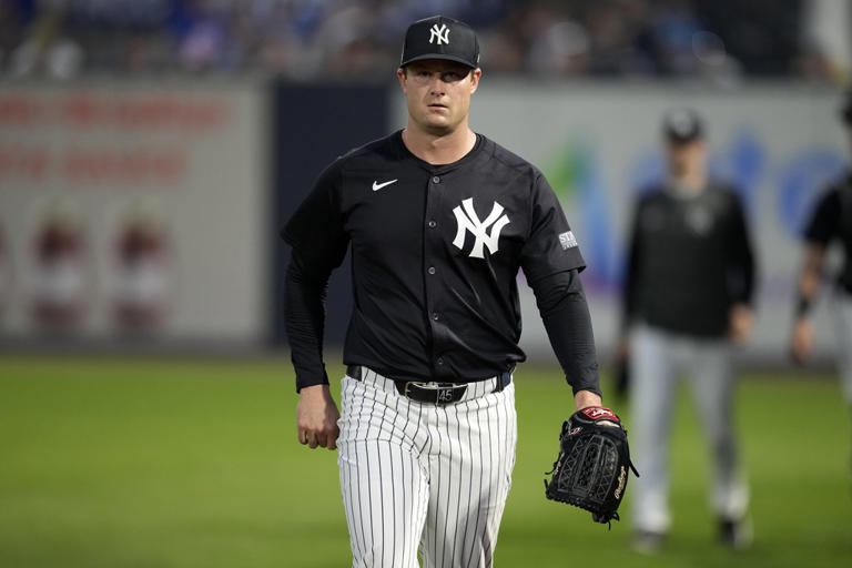 Codos de Cole y Giolito llaman la atención previo a juego de práctica entre Yanquis y Medias Rojas