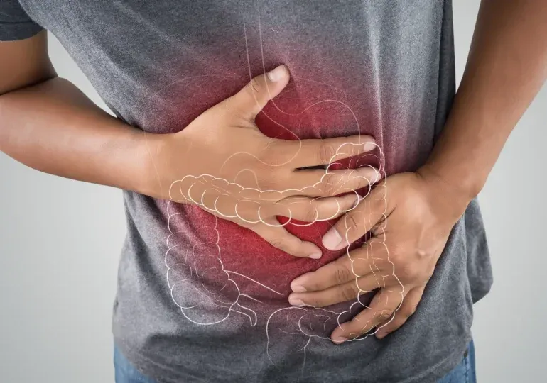 Crece el número de personas que padecen cáncer de colon y recto a temprana edad en RD