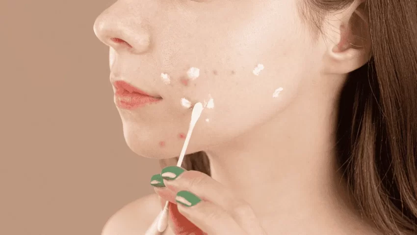 Técnicas para desinflamar un grano