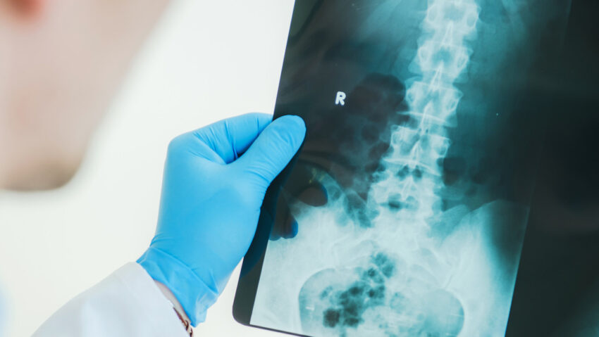 Obligan a los médicos británicos preguntar a los hombres si están en embarazo