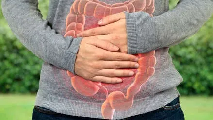 Cáncer Colorrectal: síntomas y prevención