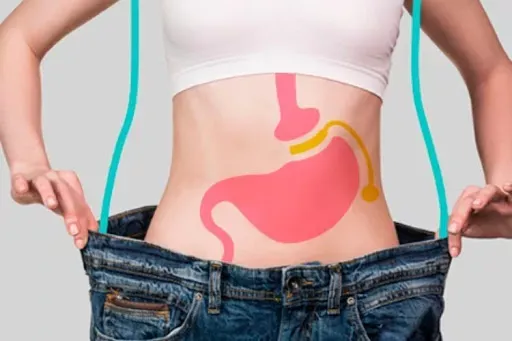 Altos niveles sobrepeso estimulan cirugías plásticas