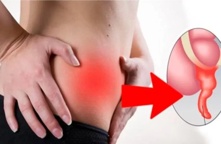 La apendicitis es un enemigo silencioso que no puede subestimarse