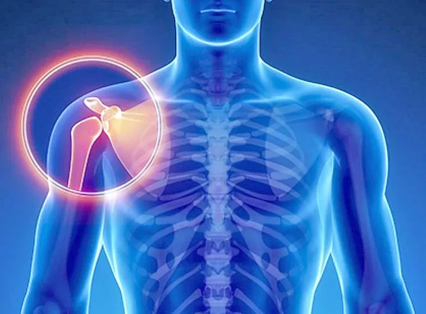 Sarcoma: el cáncer silencioso que amenaza a jóvenes