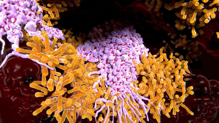 Esta enfermedad cobra las vidas de más de un millon de personas cada año