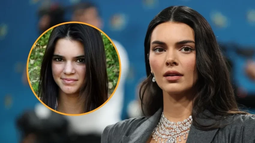 Kendall Jenner jura que nunca se ha hecho cirugía plástica en el rostro