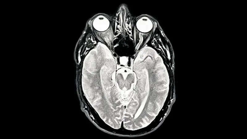 El amor no está en el corazón: José Joaquín Puello explica qué dice la ciencia