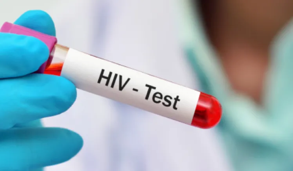 Panamá oficializa plan nacional contra el VIH con meta de frenar la epidemia al 2030