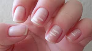 ¿Sabes por qué aparecen las manchas blancas en las uñas?