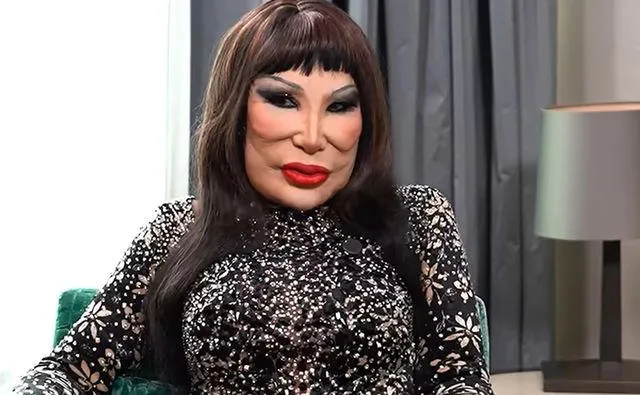 La cruda confesión de Lyn May: El dolor detrás de la deformación de su rostro y su lucha por la superación