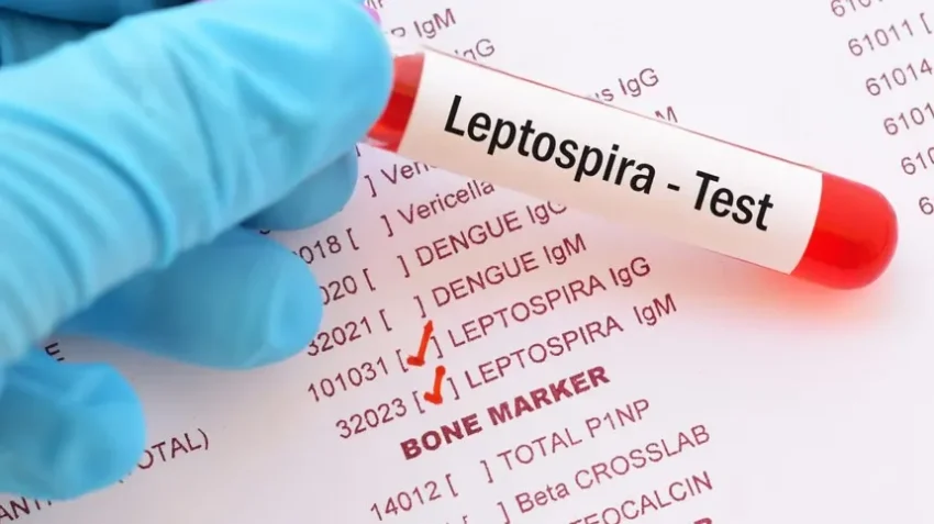 Leptospirosis suma 20 muertes y los casos confirmados aumentan un 87 %